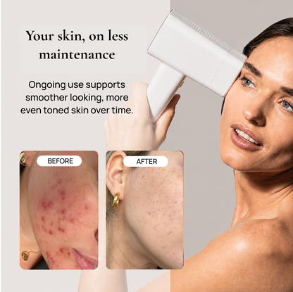 Veloura SilkRay